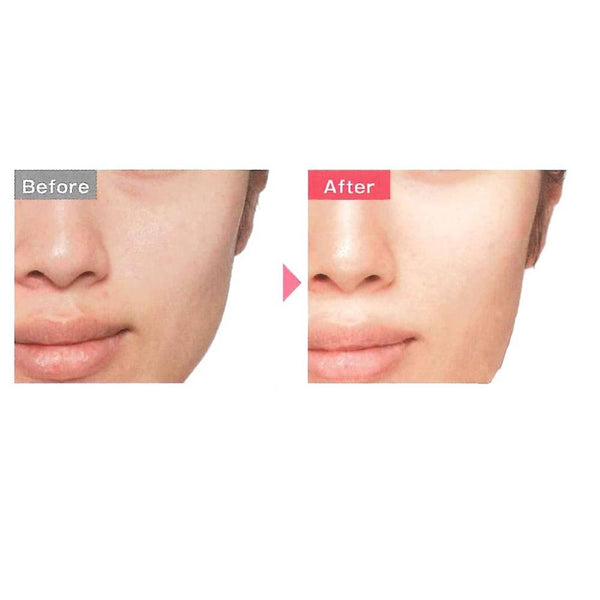 Cefine Herb Clear Milk Peeling Emulsion 120ml