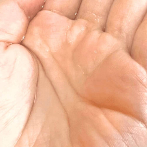 Kracie Hadabisei Acne Care Lotion Face Toner for Acne & Scars 200ml