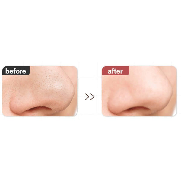 Allna Organic Cleansing Oil For Sensitive Skin 200ml